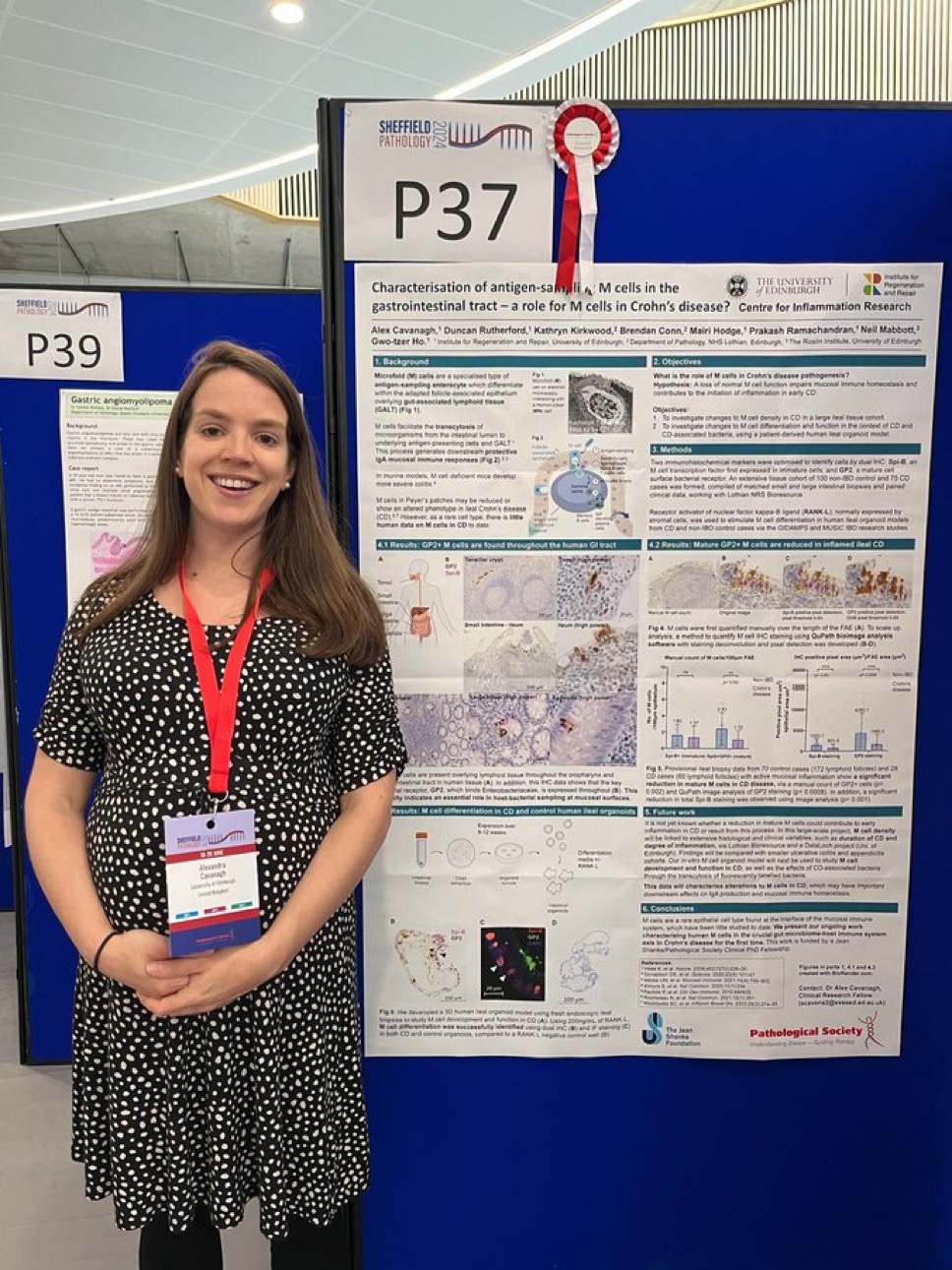 Dr Alex Cavanagh wins the top Sir Alastair Currie poster prize at Sheffield Pathology 2024 